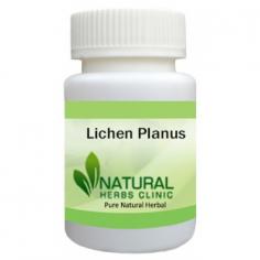 Herbal Supplements for Lichen Planus are very useful to treat the condition in natural manners. Utilize Herbal Supplements if you are a patient with Lichen Planus.