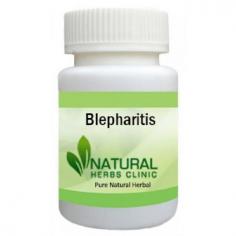 Herbal Supplements for Blepharitis are extremely helpful to get rid of the issue simply in a natural method. Try Herbal Supplements if you are affected by Blepharitis.