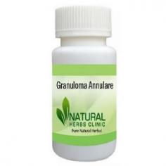 4 Natural Remedies for Granuloma Annulare to Stop the Skin Disease
Green Tea is one of the very cooperative liquids you could drink each day, and it's miles utilized in Natural Remedies for Granuloma Annulare and many different diseases. It is an incredibly wealthy supply of antioxidants withinside the form of flavonoids named catechins.
https://sites.google.com/view/naturalherbsclinics
