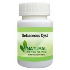 Herbal Treatment for Sebaceous Cyst read the Symptoms and Causes. Natural Remedies for Sebaceous Cyst reduce the size and growth of cyst. Supplement fantastic pain relieving.