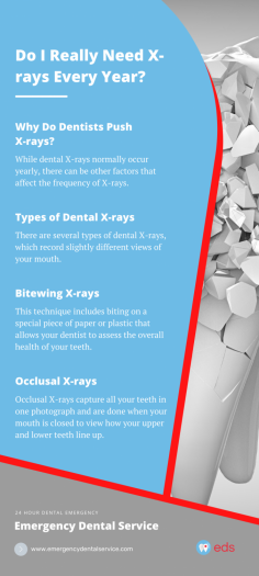 For routine dental x-rays, you should visit your dentist twice a year. If your teeth are impacted or infected, you may need to have your teeth checked with x-rays more often. For any dental issues, immediately visit the nearest 24 Hour Emergency Dentist.