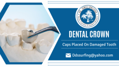 Recreate Your Tooth Appearance

Our doctors will check the patient's problem in their tooth and then suggest an ideal dental crown. This element will replace the external portion of the tooth and helps to create the best smile. Ping us an email at  ddssurfing@yahoo.com.