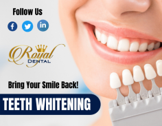 Safely Whiten Your Teeth with Our Dentist


If you are ready to get started on your brighter, let the cosmetic dentist can help! Our experts use a higher-concentration treatment that will brighten your smile by numerous shades in just one office visit. Send us an email at royaldentalal@gmail.com for more details.
