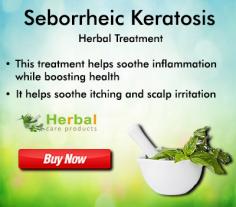 Seborrheic keratosis removal can be done at home with a few Natural Remedies for Seborrheic Keratosis. Here are a few natural methods for seborrheic keratosis removal: You can also try some natural and easy Home Remedies for Seborrheic Keratosis.