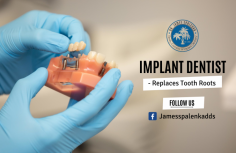 Long-Lasting Artificial Tooth 


The perfect dental implant treatment will provide by our James Spalenka, DDS center. The process of restoration is artificial tooth roots placed in the jawbone which will support your eating. Ping us an email at ddssurfing@yahoo.com.
