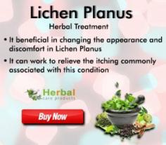 There are various Home Remedies for Lichen Planus that may well prove effective. The advantage of Herbal Treatment for Lichen Planus is that they are safe and likely it free from any kind of harmful side effects. 