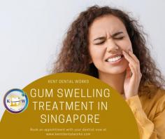 Gum swelling is a common condition in Singapore. It is usually caused by an infection, such as gingivitis or periodontitis. The infection causes the gums to become inflamed and to swell. Gum swelling can also be caused by other conditions, such as allergies, autoimmune disorders, and certain medications. If you are experiencing gum swelling, it is important to see a dentist in Singapore so that the cause can be determined and treated accordingly. In most cases, gum swelling Singapore can be resolved with proper dental care. However, if left untreated, the condition can lead to more serious problems, such as tooth loss.

