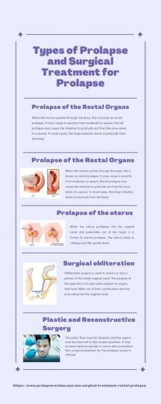When a tissue or organ slides down from its usual place, it is called a prolapse. Prolapsed discs typically do not cause any symptoms, and the problem is only found during a routine check for another reason. 