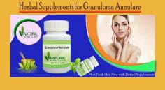 Herbal remedies and Herbal Supplements for Granuloma Annulare are well-known ways to protect skin from bacteria that cause skin diseases.
