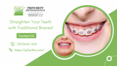 Correct Misaligned Teeth with Braces


Make your smile glossy and even by using premium-quality orthodontic braces along with the guidance of experienced orthodontists to push it better than before. Schedule an appointment with Pritchett Orthodontics to figure out your suitable treatment methods and options right now! Get your wider laugh on!

