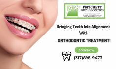 Multispecialty Orthodontic Clinic in Indianapolis

Treating your orthodontic faults and smile makeover procedures is simple and effective with Pritchett Orthodontics as we heed state-of-the-art technology without cutting corners on the benefits. Reach us to gain quick healing and easy dental procedures to even your uneven teeth and look. Book an appointment today!