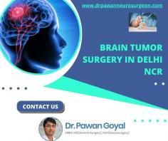 A head injury happens as a consequence of trauma to the scalp, skull, or brain and may be classified as closed (no cut to the skin) or piercing (skin and/or bone of the skull is broken). Dr. Pawan Goyal is specialised in Brain Tumor Surgery in Delhi NCR for treating your problems. Visit: https://www.drpawanneurosurgeon.com/brain-tumor-treatment-gurgaon/