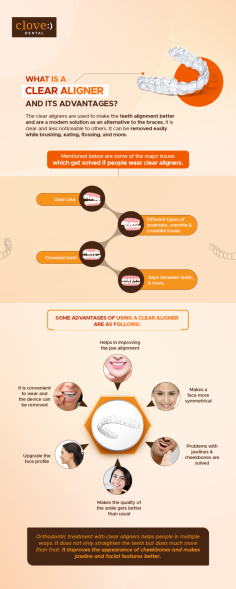 The clear aligners are used to make the teeth alignment better and are a modern solution as an alternative to the braces. It is clear and less noticeable to others. It can be removed easily while brushing, eating, flossing, and more. 
