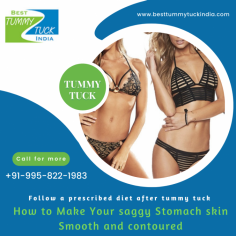 How to Make Your saggy 
Stomach skin 
Smooth and contoured
✅ 35+ years experience
✅ Triple American Board Certified Plastic Surgeon
Call +91-9958221983 or share your contact details, our medical 
counselor will help you to plan the treatment.
Aya Nagar, Pillar 184, Arjan garh Metro Station, New Delhi