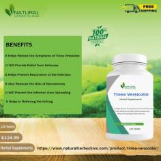 Natural Herbs Clinic prepared helpful Natural Remedy for Tinea Versicolor natural recovery. Try this natural herbal remedy to treat the condition naturally.
