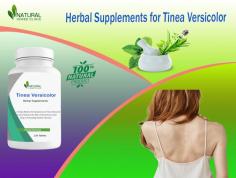 If you want to get natural recovery of Tinea Versicolor utilizes Natural Herbs Clinic Natural Remedy for Tinea Versicolor which provides wonderful treatment result.
