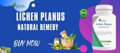 Herbal remedies have been used for centuries to treat a variety of ailments, including Lichen Planus. In this article, we will discuss some of the best Herbal Remedies for Lichen Planus and how they can be used to help manage its symptoms.
