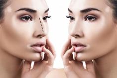 Nose augmentation is a very popular request at Regent Street Clinic Dubai. The main indication is for the dorsal hump at the bridge of the nose and this area can be treated very effectively by experienced clinicians.

Visit more: https://www.regentstreetclinicdubai.com/nose/