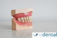 Virgin Island Dental Center | Partial Dentures | St. Thomas Dentist, St. Croix Dentist 

A removable partial denture is designed specifically to meet the needs of the patient and can replace one or more missing teeth. A natural appearance and speech clarity is restored along with the ability to eat more efficiently.