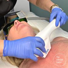 This month you can get a FREE BBL Forever Young laser treatment when you purchase 4 vials of Sculptra. BBL is a one-stop procedure that treats a wide array of skin concerns including:

