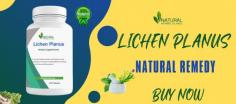 We will discuss here some of the most effective Home Remedies for Lichen Planus that you can use to manage your symptoms and improve your quality of life.
