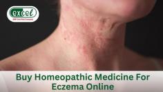 Are you tired of living with persistently itchy and scaly symptoms of Eczema? Don't worry! Homeopathy can help you out. E-Derma Drops (AKG - 66) is one of the best Homeopathic medicines for Eczema and for treating various skin problems, including  Urticaria, Allergic Dermatitis, Psoriasis, etc. In addition, Homeopathic medicine for Eczema provides sustained relief from the condition with little or no flare-ups.  
At Excel Pharma, we are among the top manufacturers and providers of effective Homeopathic medicines for human and veterinary diseases. Here, you can get some of the best Homeopathic medicines for Eczema at affordable prices. To book your consultation or order your Homeopathic medicine for Eczema online, Call or WhatsApp us at +91 9815567678.