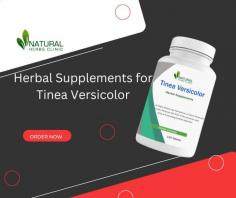 If you’re looking for a natural Home Treatment for Tinea Versicolor, look no further than Natural Herbs Clinic. We’re here to help you get the relief you need and get back to feeling your best.
