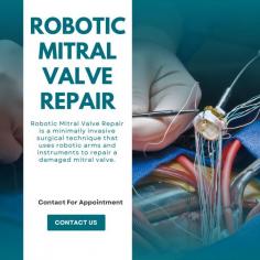 Don't let mitral valve disease go untreated. Robotic mitral valve repair offers a safer and more effective alternative to traditional surgery. Contact us today to schedule an appointment and improve your heart health. For more info visit our website.
