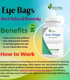 Natural Herbs Clinic offers natural treatments and Natural Remedies for Eye Bags that can help reduce the appearance of eye bags without the need for invasive procedures.
