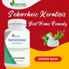 Natural Remedies for Seborrheic Keratosis can aid in reducing the swelling and irritation brought on by the condition.