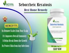 It has been proven that Home Remedies for Seborrheic Keratosis like apple cider vinegar and tea tree oil will assist with the discomfort.
