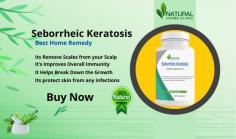 This article provides information on Natural Remedies for Seborrheic Keratosis and natural cures. Learn about the use of home remedies.