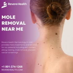 Mole removal, which is different than mole biopsy, is designed to completely remove moles from the skin in a way that minimizes scarring and creates a smooth, discreet finish. If you’re ready to learn more about how mole removal can help you achieve your aesthetic goals and keep your skin healthy. If you are looking for Mole Removal Near Me. Call to schedule an initial consultation today! (801) 429-8000. https://reverehealth.com/specialty/dermatology/