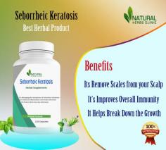 Natural Treatment for Seborrheic Keratosis using home remedies are discussed in this article. Discover how to use DIY treatments.