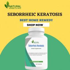 This article offers details on Natural Treatments for Seborrheic Keratosis. Learn how to apply natural treatment to get rid of it.
