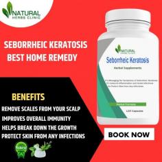 It has been demonstrated that using Natural Remedies for Seborrheic Keratosis, such as apple cider vinegar and tea tree oil, can help with the discomfort and outward signs of the condition.
