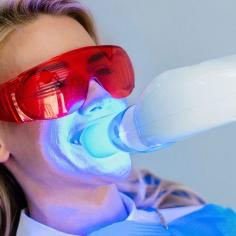 Here at Aloha Dental, we are proud to offer best whitening services to our patients in Silverdale WA. Most teeth whitening products use bleach to get natural color.
