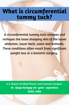 hat is circumferential tummy tuck? 
know with U.S. board certified Plastic & Cosmetic surgeon -
www.besttummytuckindia.com
for more - 
Call or WhatsApp: +91-9958221983, 9958221981
Email : info@besttummytuckindia.com
YouTube : https://www.youtube.com/watch?v=cVOdFq1HlRo&t=2s