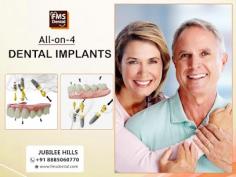 all on 4 dental implant In Jubilee Hills