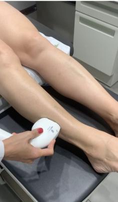 MedSpa California can successfully treat both spider veins and varicose veins in San Ramon.  We specialize in laser vein removal treatment in Danville.
