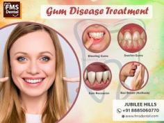 Bleeding Gum Treatment