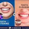 Best Dental Clinic In Secunderabad