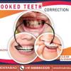 Best Dental Clinic In Secunderabad