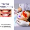 Best Dental Clinic In Secunderabad