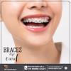 Best Dental Clinic In Secunderabad