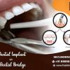 Best Dental Clinic In Secunderabad