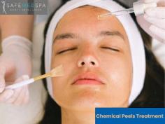 Revitalize your skin with a safe and effective chemical peel at Safe Dermatology & Med Spa of Lansing. Our expert staff will help you achieve a smoother, more radiant complexion using the latest techniques and highest-quality products.