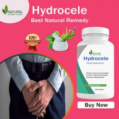 If you’re looking for a natural treatment for hydrocele, then this article is for you. Here, we’ll discuss the top 5 hydrocele home remedies for quick relief. Let’s dive in.
