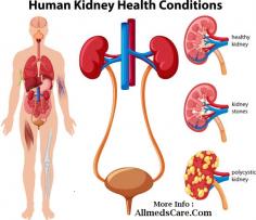 Know about kidney health and its failure - https://www.allmedscare.com/causes-and-treatments-of-kidney-failure.html