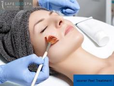 Jessner peel treatment is a safe and effective med spa procedure that helps to improve the appearance of acne scars, sun damage, and fine lines.At our med spa, we use only the highest quality products to ensure optimal results and minimal downtime for our clients.For more information visit our website.  https://www.safemedspa.com/jessners-peel/

